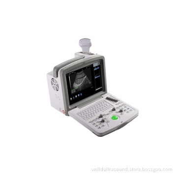 Full Digital Ultrasound Diagnostic System